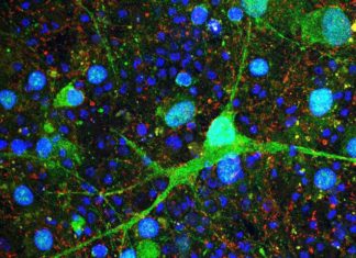 LAB GROWN HUMAN CEREBELLAR CELLS YIELD CLUES TO AUTISM