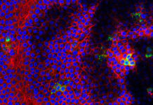 Like Zika, West Nile virus causes fetal brain damage, death in mice