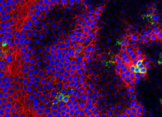 Like Zika, West Nile virus causes fetal brain damage, death in mice