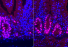 Low-calorie diet enhances intestinal regeneration after injury