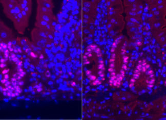 Low-calorie diet enhances intestinal regeneration after injury