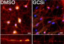 Mechanism behind common Parkinson’s mutation discovered