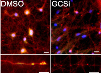 Mechanism behind common Parkinson’s mutation discovered