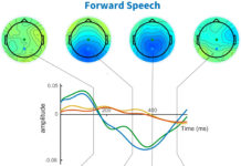 Neuroscientists discover a brain signal that indicates whether speech has been understood