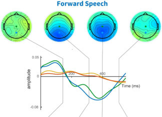 Neuroscientists discover a brain signal that indicates whether speech has been understood