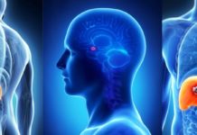 New algorithm decodes spine oncology treatment