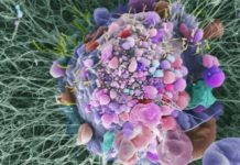 New immunotherapy combination tolerable, effective in patients with advanced kidney cancer