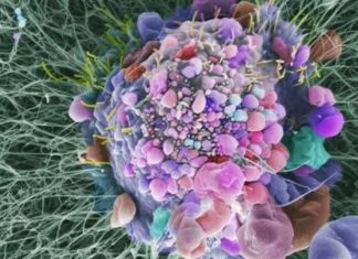 New immunotherapy combination tolerable, effective in patients with advanced kidney cancer