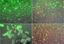New research could lead to improved method of treating pancreatic cancer