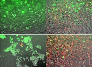 New research could lead to improved method of treating pancreatic cancer