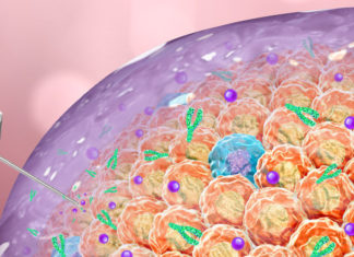 New therapeutic gel shows promise against cancerous tumors