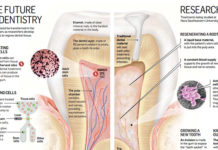 Researcher uses stem cells to attack bacteria and regenerate dental pulp