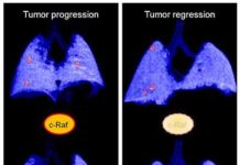 Researchers discover a potential new therapeutic strategy for pancreatic cancer