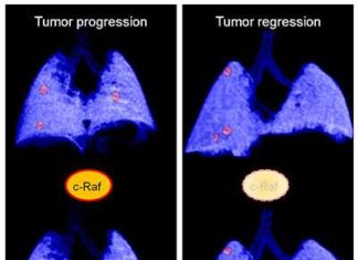 Researchers discover a potential new therapeutic strategy for pancreatic cancer