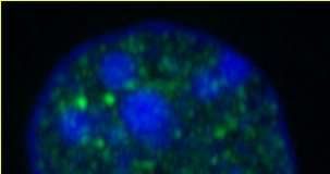 Researchers discover how liver responds so quickly to food
