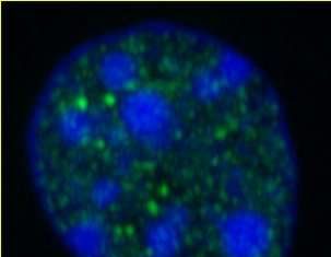 Researchers discover how liver responds so quickly to food