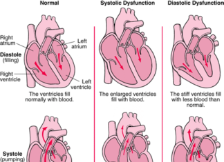 Researchers identify potential treatment for diastolic dysfunction in heart failure