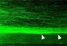 Researchers use human neural stem cell grafts to repair spinal cord injuries in monkeys