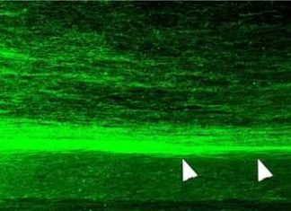 Researchers use human neural stem cell grafts to repair spinal cord injuries in monkeys