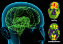 Schizophrenia is a Side Effect of Human Development