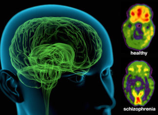 Schizophrenia is a Side Effect of Human Development