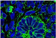 Scientists create functioning kidney tissue
