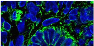 Scientists create functioning kidney tissue