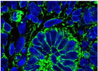 Scientists create functioning kidney tissue