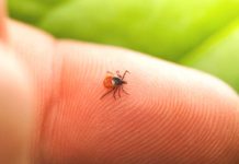 Severe and lingering symptoms occur in some after treatment for Lyme disease