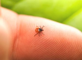 Severe and lingering symptoms occur in some after treatment for Lyme disease