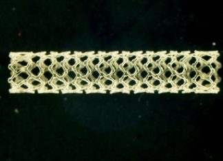 Study reveals why polymer stents failed