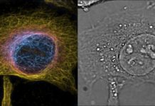Super-resolution microscopy in both space and time