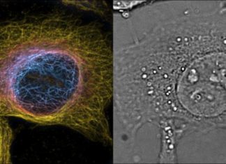 Super-resolution microscopy in both space and time