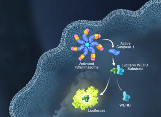 Scientists discover off-switch for ‘molecular machine’ active in many diseases