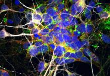 The toxic relationship between ALS and frontotemporal dementia