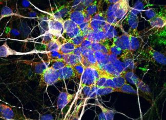The toxic relationship between ALS and frontotemporal dementia
