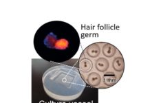 To baldly grow: Japan scientists regrow hair at record rate