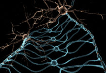Watching Myelin Patterns Form