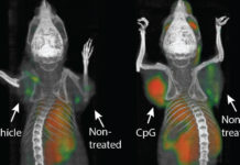 Cancer vaccine eliminates tumors in mice