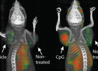 Cancer vaccine eliminates tumors in mice
