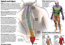 Spinal cord injury research: Bonus benefit to activity-based training