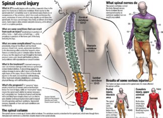 Spinal cord injury research: Bonus benefit to activity-based training
