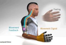 A Way to Restore Movement Sensation in Upper Limb Amputation Patients