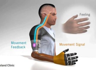 A Way to Restore Movement Sensation in Upper Limb Amputation Patients