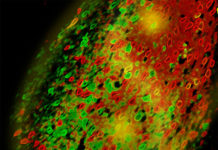Amygdala neurons increase as children become adults – except in autism