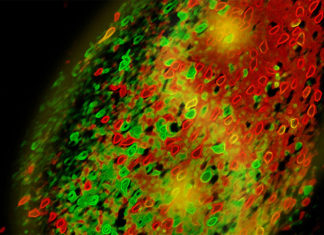Amygdala neurons increase as children become adults – except in autism