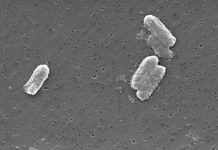 Bacteria resistant to last-resort antibiotic, missed by standard tests