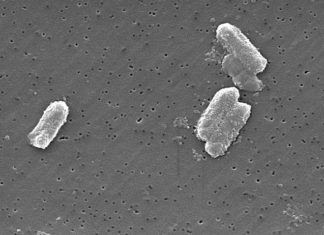 Bacteria resistant to last-resort antibiotic, missed by standard tests