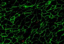Blocking a protein could improve the effectiveness of intravascular cellular ‘policing’