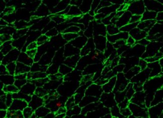 Blocking a protein could improve the effectiveness of intravascular cellular ‘policing’